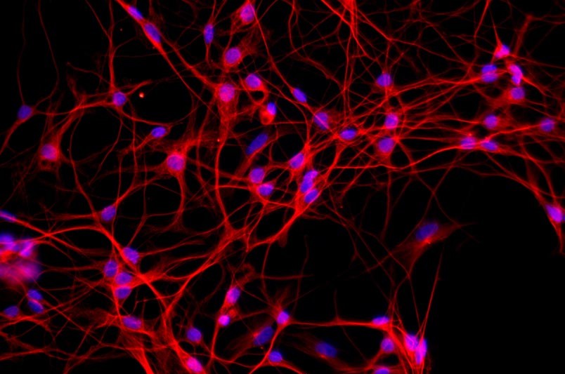 小鼠原代細(xì)胞